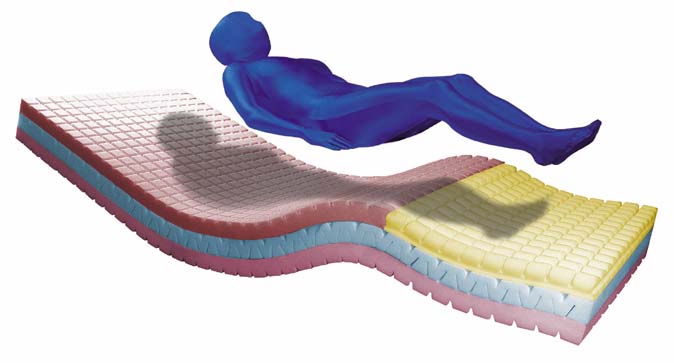 blue chip medical mattress prevention